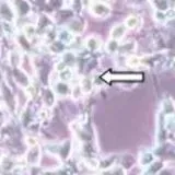 thumbnail for publication: Spring Viremia of Carp Virus (SVCv)